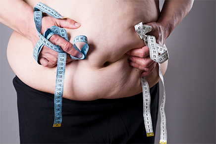 bariatric surgery