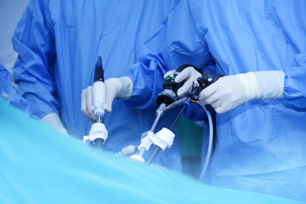 laparoscopic gallbladder surgery