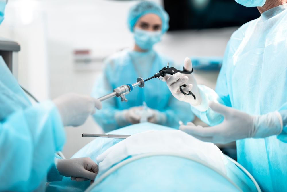 laparoscopic surgery