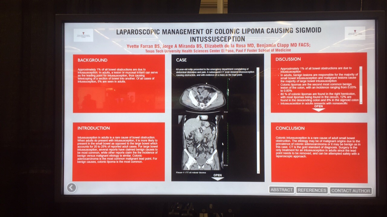 Poster presentation at the Society of American Gastrointestinal and Endoscopic Surgeons, Seattle, WA,  Apr 2018.